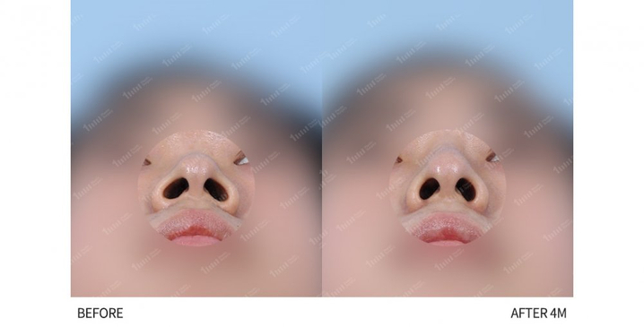 Slider image (5) 1mm Plastic Surgery